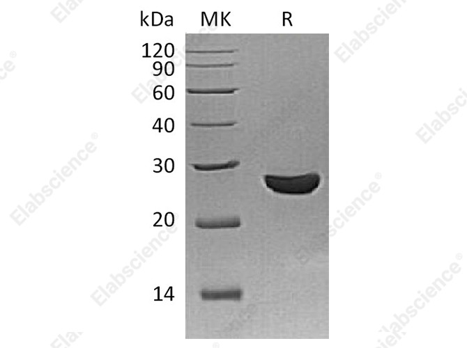 Recombinant Schistosoma Japonicum GST 26 Protein - 1