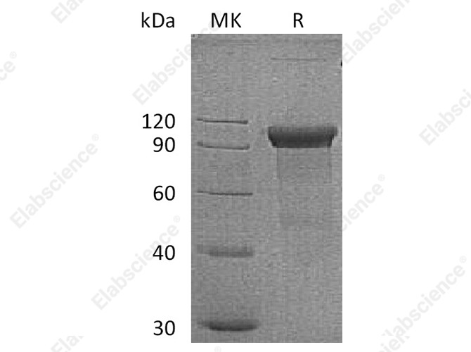 Recombinant Human ROR1 Protein (Fc Tag) - 1