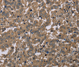 CAB39 Polyclonal Antibody - 3
