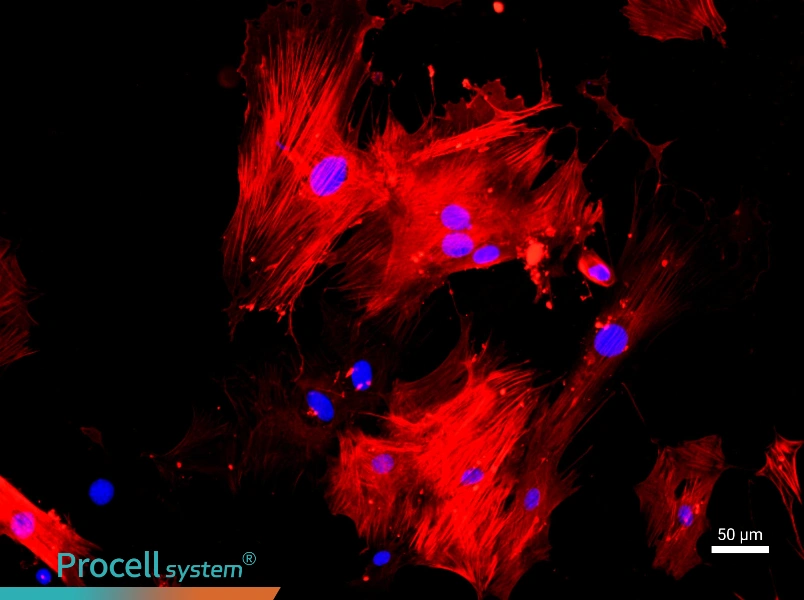 Mouse Aortic Smooth Muscle Cells - 1