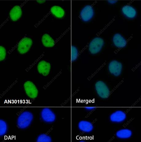 Recombinant CHD4 Monoclonal Antibody - 1
