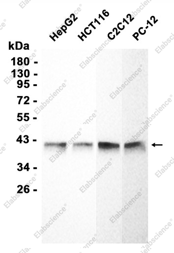 Recombinant ATP6V0D1 Monoclonal Antibody - 1