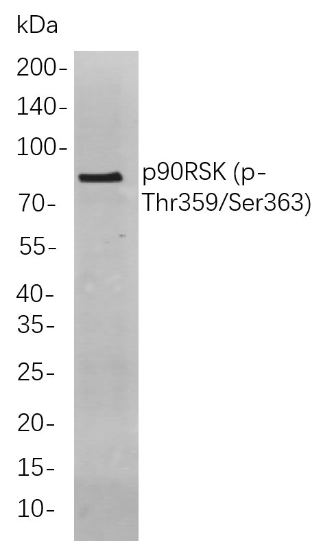 Recombinant Phospho-p90RSK（Thr359, Ser363) Monoclonal Antibody-searchlist-1