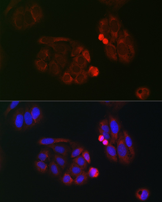 Immunofluorescence analysis of U2OS cells using eIF4A Polyclonal Antibody at dilution of 1:100 (40x lens). Blue: DAPI for nuclear staining.