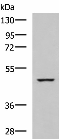 Western blot analysis of K562 cell lysate  using IP6K2 Polyclonal Antibody at dilution of 1:650