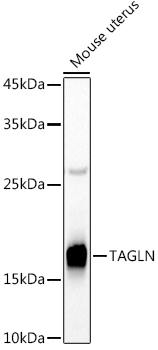 Western blot analysis of extracts of Mouse uterus using Transgelin (TAGLN) Polyclonal Antibody at 1:500 dilution.