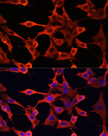Immunofluorescence analysis of NIH/3T3 cells using TYMS Polyclonal Antibody at dilution of 1:100. Blue: DAPI for nuclear staining.