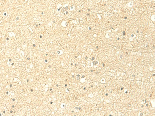 Immunohistochemistry of paraffin-embedded Human brain tissue  using MTHFS Polyclonal Antibody at dilution of 1:50(?200)