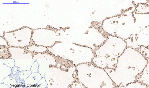 Immunohistochemistry of paraffin-embedded Human lung tissue using Desmin Monoclonal Antibody at dilution of 1:200.