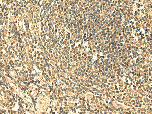 Immunohistochemistry of paraffin-embedded Human tonsil tissue  using UNKL Polyclonal Antibody at dilution of 1:50(?200)