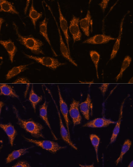 Immunofluorescence analysis of L929 cells using CCDC6 Polyclonal Antibody at dilution of  1:100. Blue: DAPI for nuclear staining.