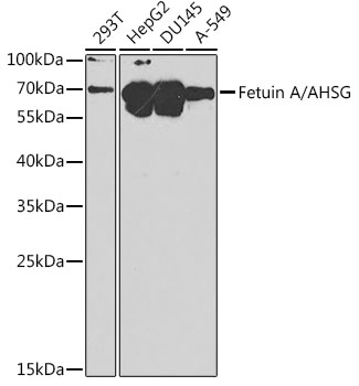 Western blot analysis of extracts of various cell lines using Fetuin A/Fetuin A/AHSG Polyclonal Antibody at 1:1000 dilution.