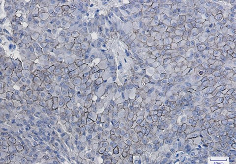 Recombinant CD166 Monoclonal Antibody - 4