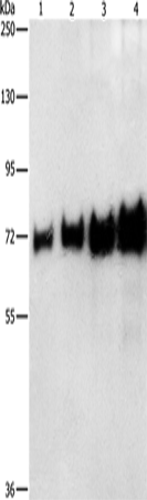 Western Blot analysis of 0.05-0.4ug BSA using BSA Polyclonal Antibody at dilution of 1:1150