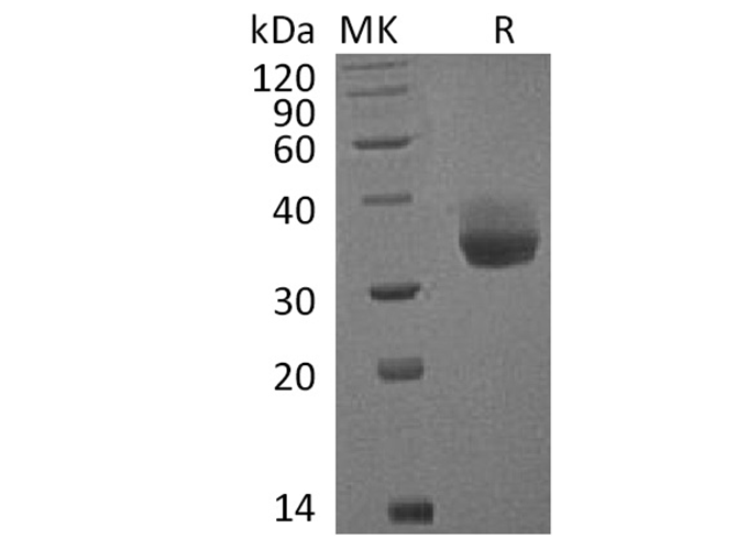Recombinant Cynomolgus PD-L1/B7-H1/CD274 Protein (His Tag)