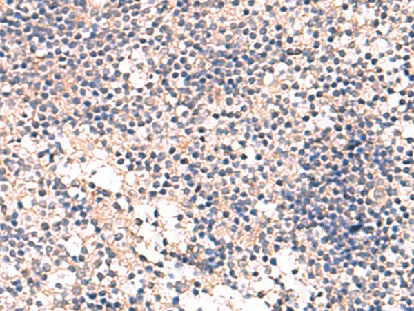 Immunohistochemistry of paraffin-embedded Human tonsil tissue  using MKS1 Polyclonal Antibody at dilution of 1:50(?200)