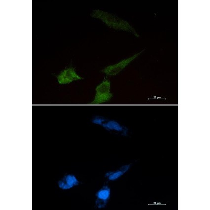 Recombinant NPC2 Monoclonal Antibody - small - 4