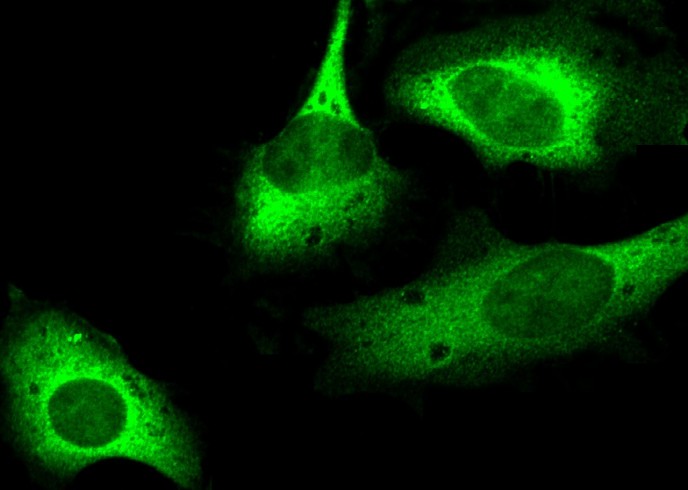 Recombinant RRM2B/P53R2 Monoclonal Antibody - small - 4