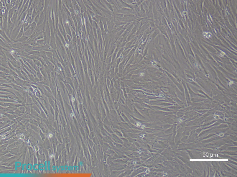Human Pulmonary Artery Smooth Muscle Cell Complete Medium - 1