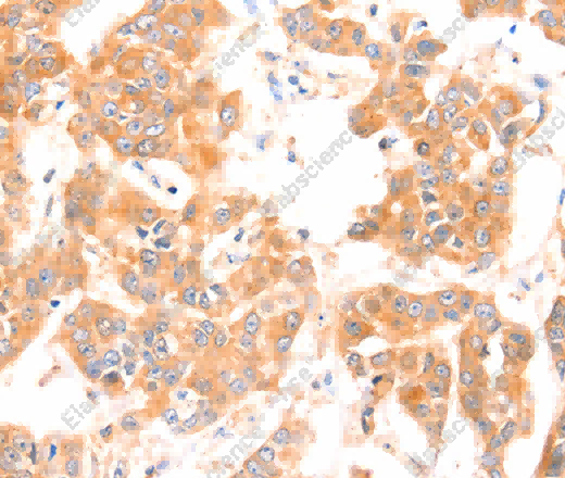 PRDX2 Polyclonal Antibody - 3