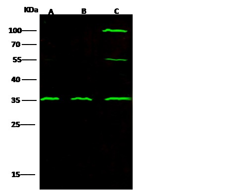 Recombinant C1QBP/HABP1 Monoclonal Antibody - small - 2