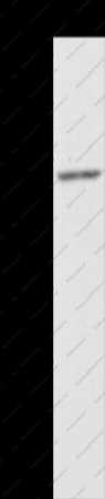 ZFP36L2 Polyclonal Antibody - 1
