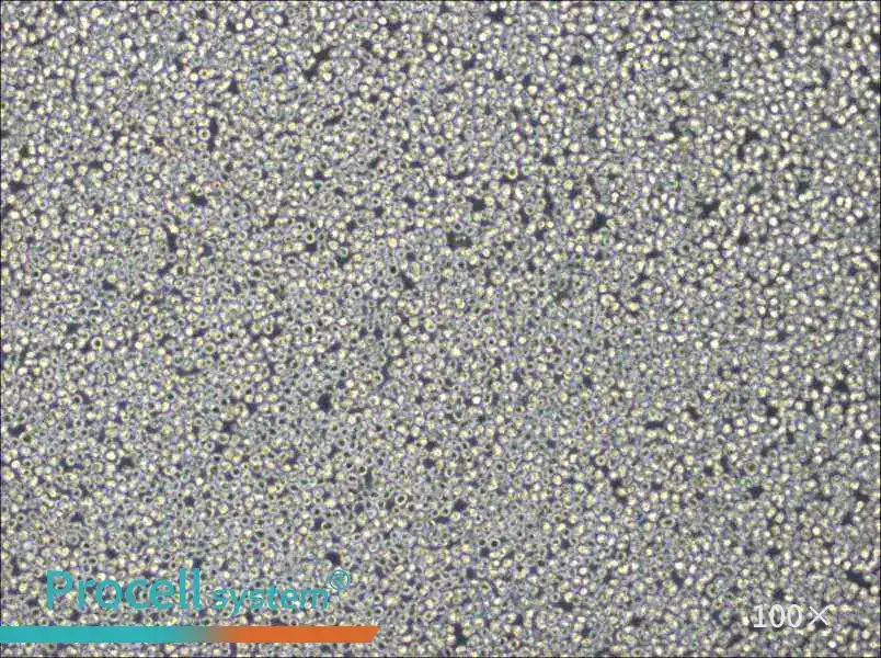 NB4 Cell Complete Medium - 2