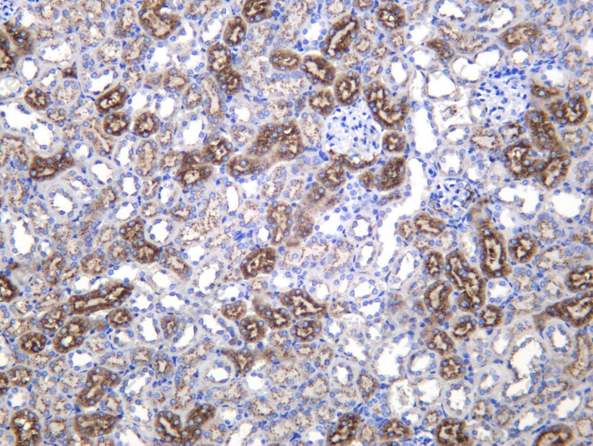 Recombinant LGMN Monoclonal Antibody - 3