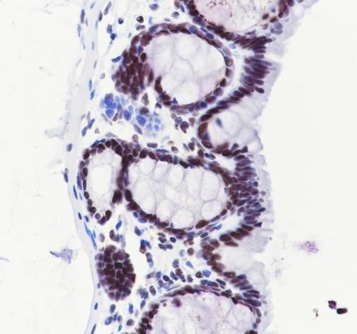 Recombinant CHD4 Monoclonal Antibody - small - 6