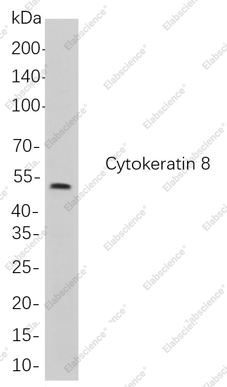 Recombinant Cytokeratin 8 Monoclonal Antibody - 1