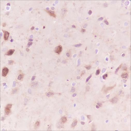 Recombinant Stathmin Monoclonal Antibody - small - 5