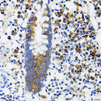 Immunohistochemistry of paraffin-embedded Human vermiform appendix using HYOU1 Polyclonal Antibody at dilution of 1:100 (40x lens).