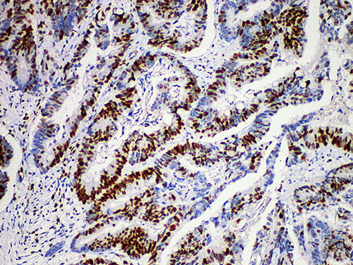 Immunohistochemistry of paraffinembedded Human lymph node tissue with MCM2 Monoclonal Antibody(Antigen repaired by EDTA).