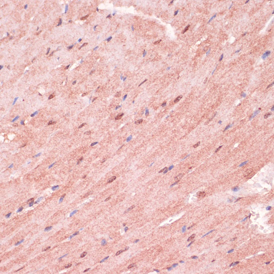 Immunohistochemistry of paraffin-embedded Mouse heart using RNF5 Polyclonal Antibody at dilution of 1:100 (40x lens).