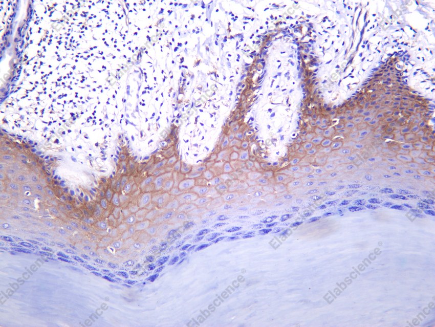 Recombinant Thrombomodulin Monoclonal Antibody - 2