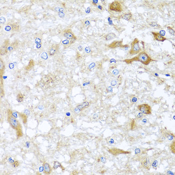 Immunohistochemistry of paraffin-embedded Rat brain using ABCB8 Polyclonal Antibody at dilution of  1:100 (40x lens).