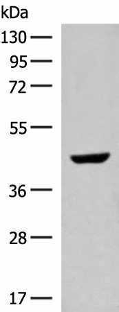 Western blot analysis of Human fetal liver tissue lysate  using GNAT1 Polyclonal Antibody at dilution of 1:250