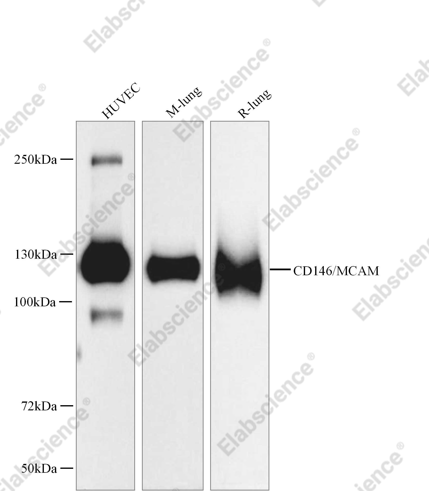 Recombinant CD146/MCAM Monoclonal Antibody - 1