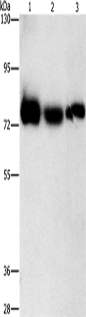 Western Blot analysis of Human fetal muscle tissue, K562 and hela cell using AMPD1 Polyclonal Antibody at dilution of 1:1600