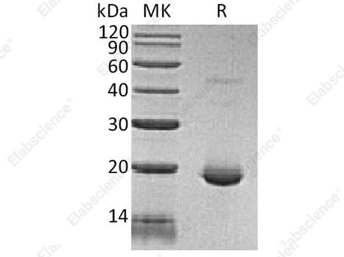 Recombinant Human IL-6/Interleukin-6 Protein - 1