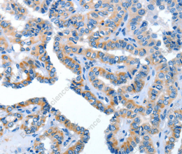 AMDHD2 Polyclonal Antibody - 2