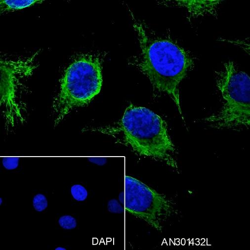 Recombinant ALOX15 Monoclonal Antibody - 3