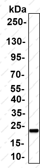 Recombinant Caveolin-3 Monoclonal Antibody - 5