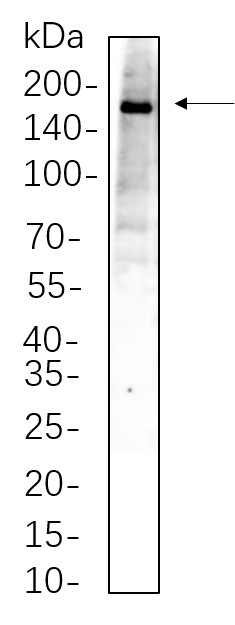 Recombinant TBC1D4 Monoclonal Antibody-searchlist-1
