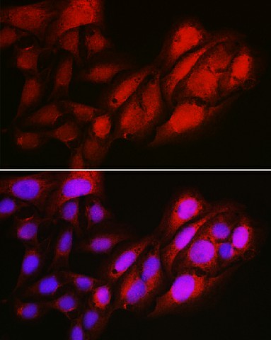 Immunofluorescence analysis of U2OS using Notch1 Polyclonal Antibody at dilution of 1:100 (40x lens). Blue: DAPI for nuclear staining.