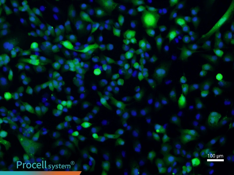 ACHN-GFPACHN-GFP - 2