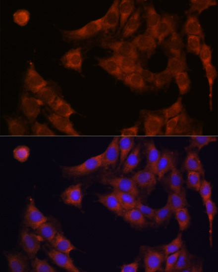 Immunofluorescence analysis of C6 cells using GANAB Polyclonal Antibody at dilution of 1:100. Blue: DAPI for nuclear staining.