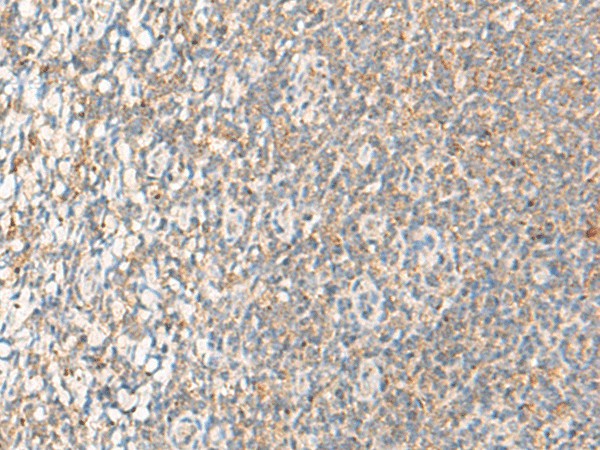 Immunohistochemistry of paraffin-embedded Human tonsil tissue  using RNF5 Polyclonal Antibody at dilution of 1:40(?200)