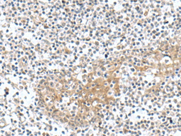 Immunohistochemistry of paraffin-embedded Human tonsil tissue  using TNNC2 Polyclonal Antibody at dilution of 1:50(?200)