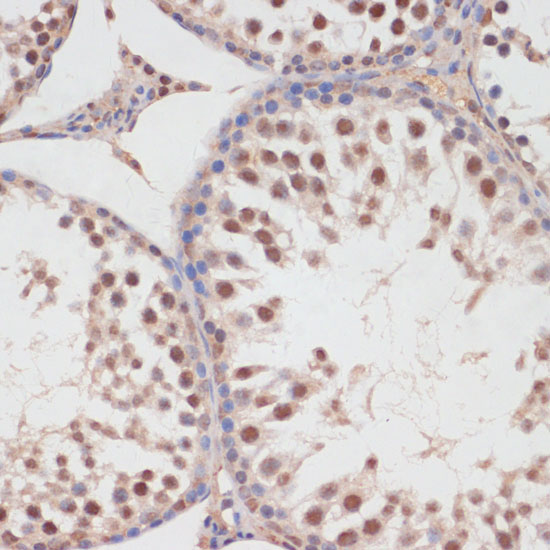 Immunohistochemistry of paraffin-embedded rat testis using HP1BP3 Polyclonal Antibody at dilution of 1:100 (40x lens).Perform microwave antigen retrieval with 10 mM PBS buffer pH 7.2 before commencing with IHC staining protocol.